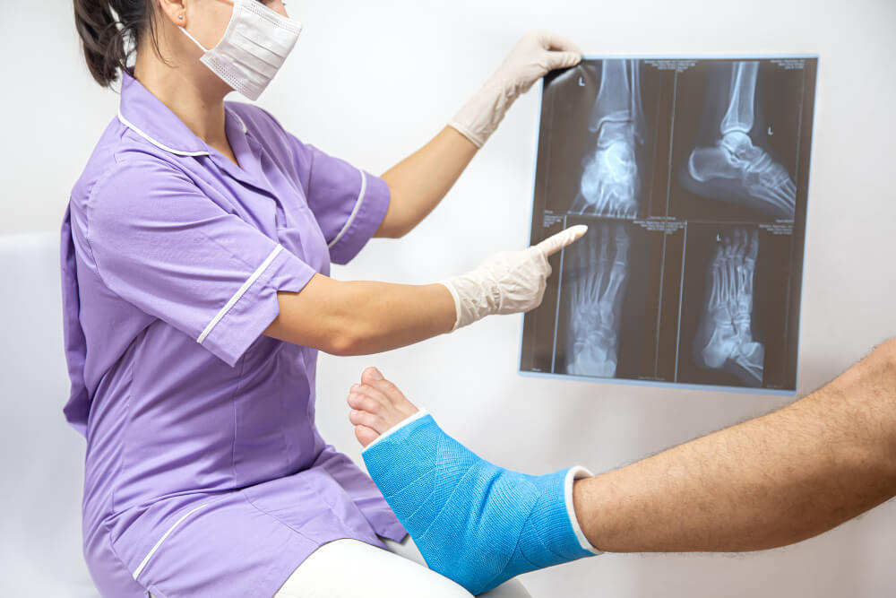 Fracture treatment with cast