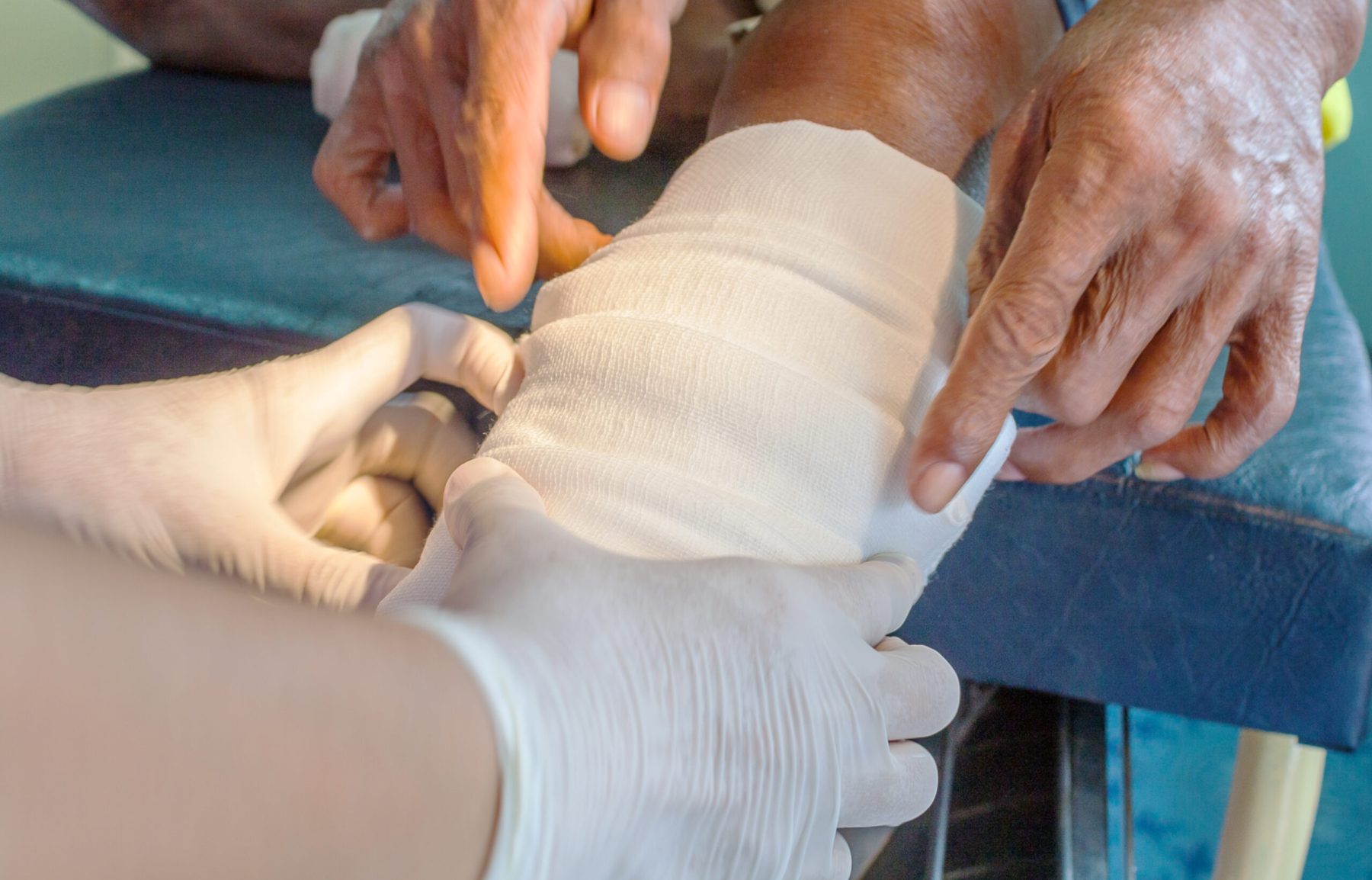 infected wound,patient man leg